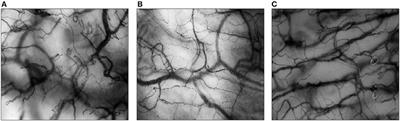 Assessing the Microcirculation With Handheld Vital Microscopy in Critically Ill Neonates and Children: Evolution of the Technique and Its Potential for Critical Care